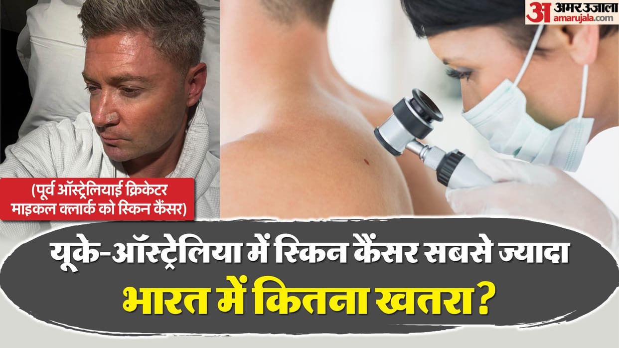 michael clarke skin cancer common in australia america know prevention tips in india