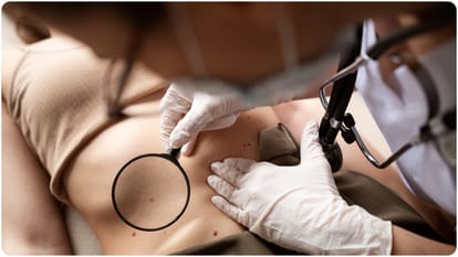 Derm Zero new AI smartphone app that can diagnose Deadly skin cancers at home
