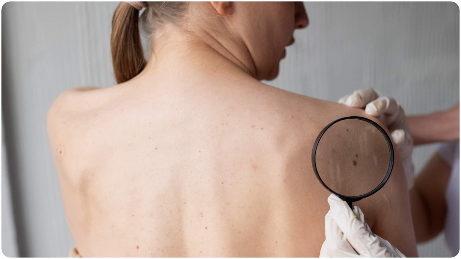 What Time to Take Sunlight to Boost Vitamin D Naturally Dhoop Lene Ka Sahi Samay