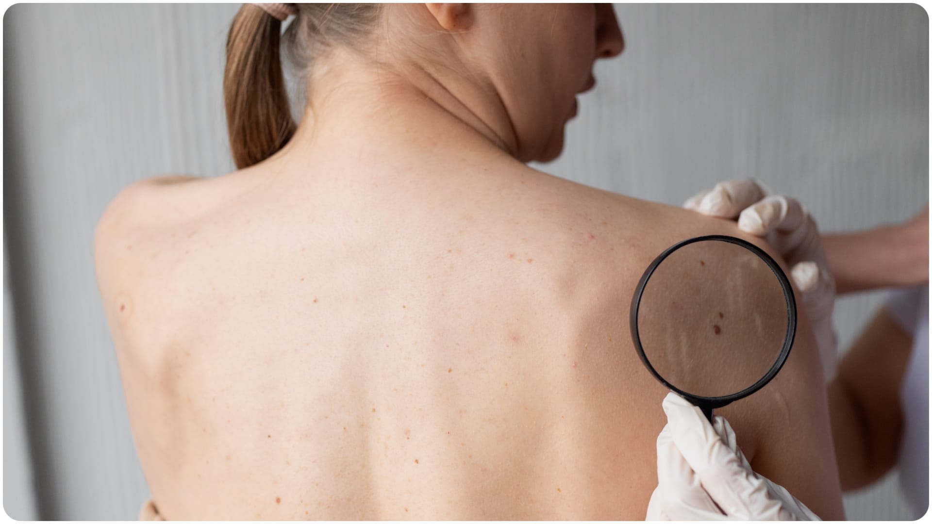 How much sun exposure enough for vitamin D in summer know vitamin d kaise badhaye