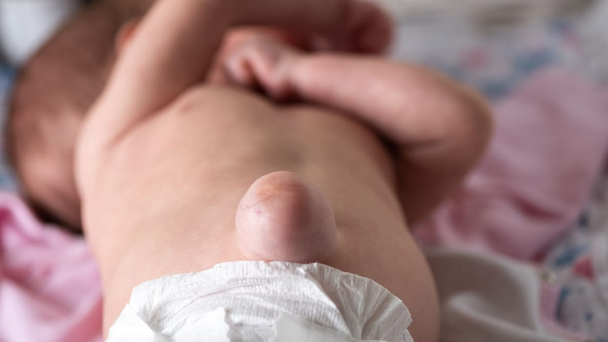 Due to these mistakes in daily routine the risk of hernia increases know in hindi