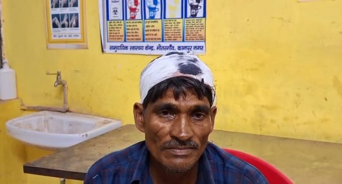 Kanpur Wife attacked husband with a hoe for making a microscope husband was bleeding admitted him to hospital