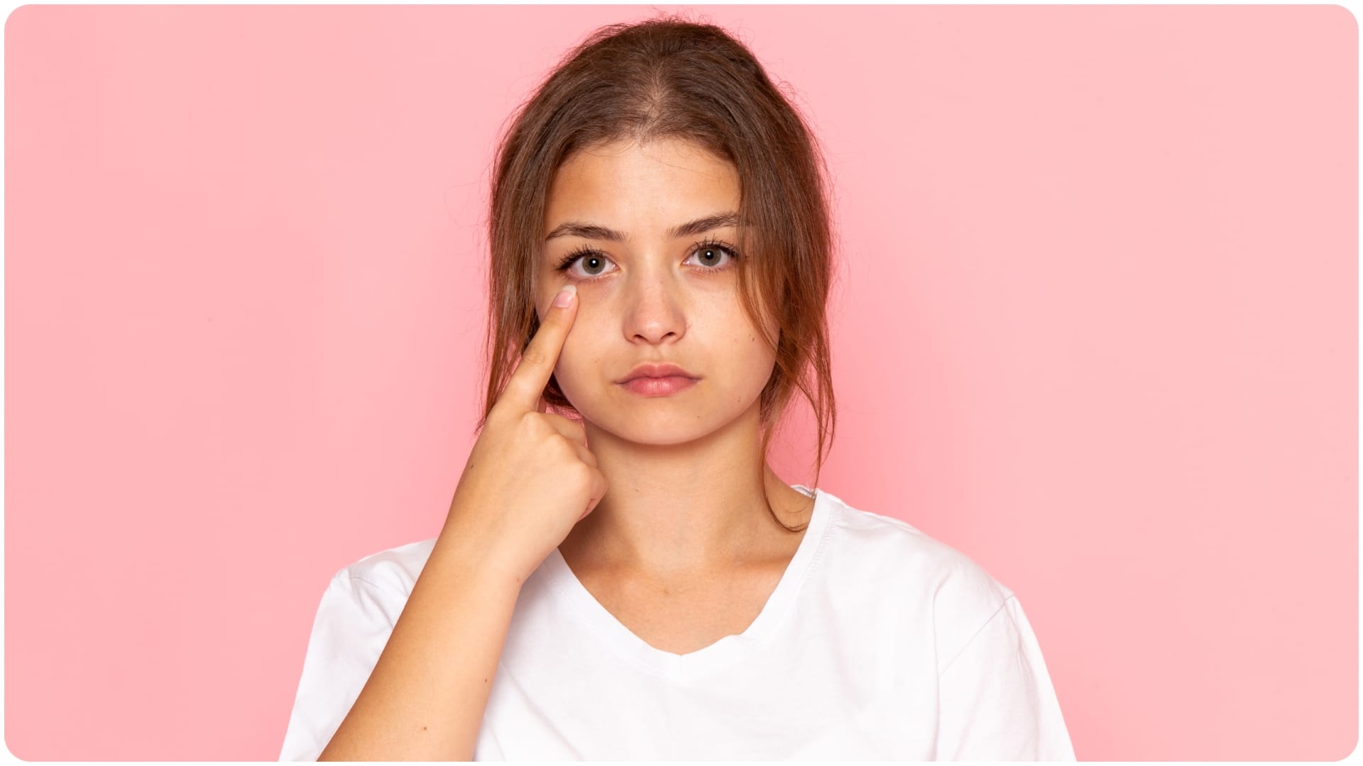 why dark circles happen even after good sleep diseases behind this