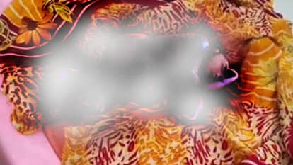 shivpuri-Birth of a newborn in a community health center whose back part of the head is missing