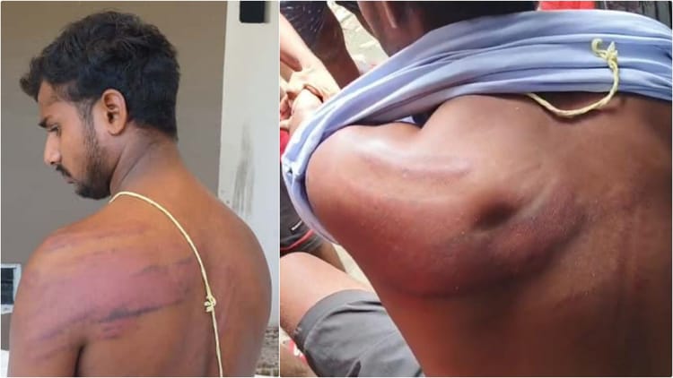 Bihar Police: पुलिस पर पिता-पुत्र को घर और थाने में पीटने का आरोप, 'पूछताछ के बाद पीआर बाउंड पर छोड़ा गया'