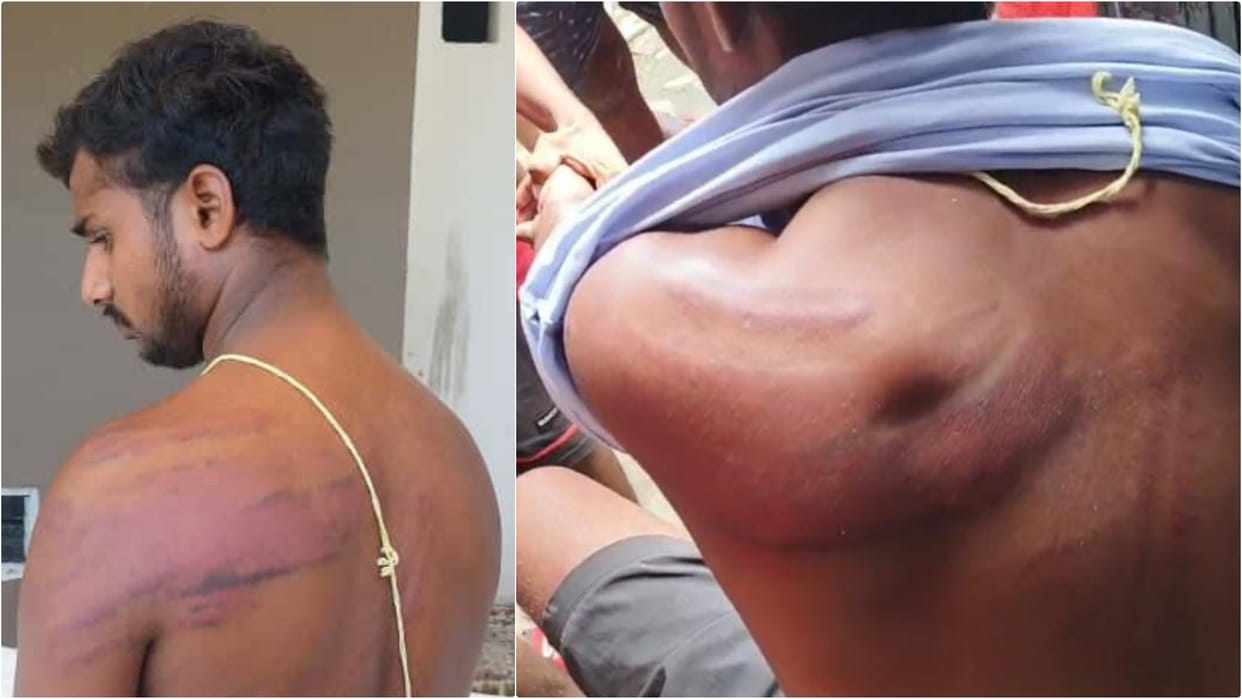 Bihar Police accused of beating father-son at home and police station, released on PR bond after interrogation