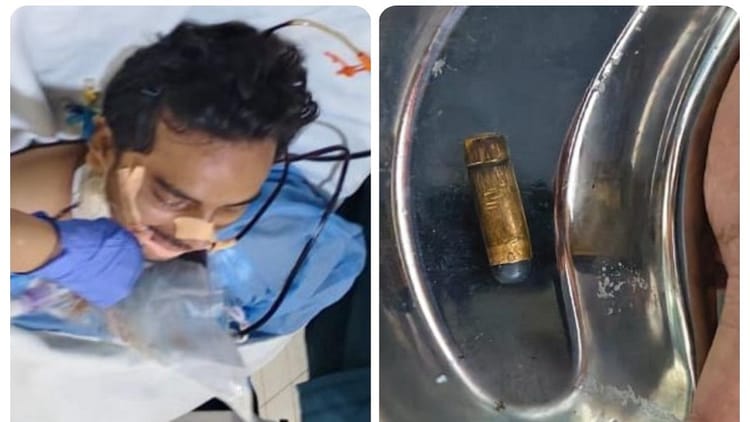 Meerut: Father Was Slapped And Sister’s Brother-in-law Was Shot, Fountain Of Blood Came Out From The Stomach – Amar Ujala Hindi News Live