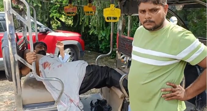 Kanpur Terror of monkeys in Narwal herd left a middle aged man bleeding three injured in two days