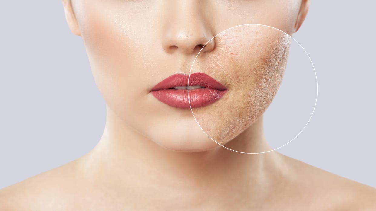 Winter Skin Care Tips Get Soft and Glowing Skin in Minutes Using Just Two Ingredients