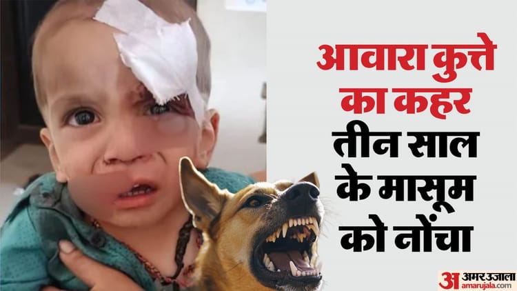 Udaipur News: आवारा कुत्ते ने मचाया आतंक, तीन साल के मासूम का होंठ नोंचा, एक किमी के दायरे में चार घायल