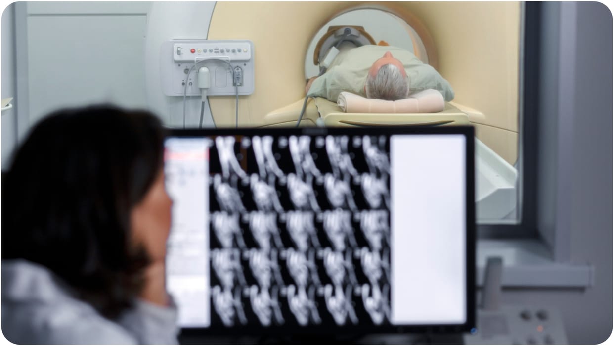 MRI study over menopause brain changes depression risk anxiety study gray matter memory loss Cambridge researc