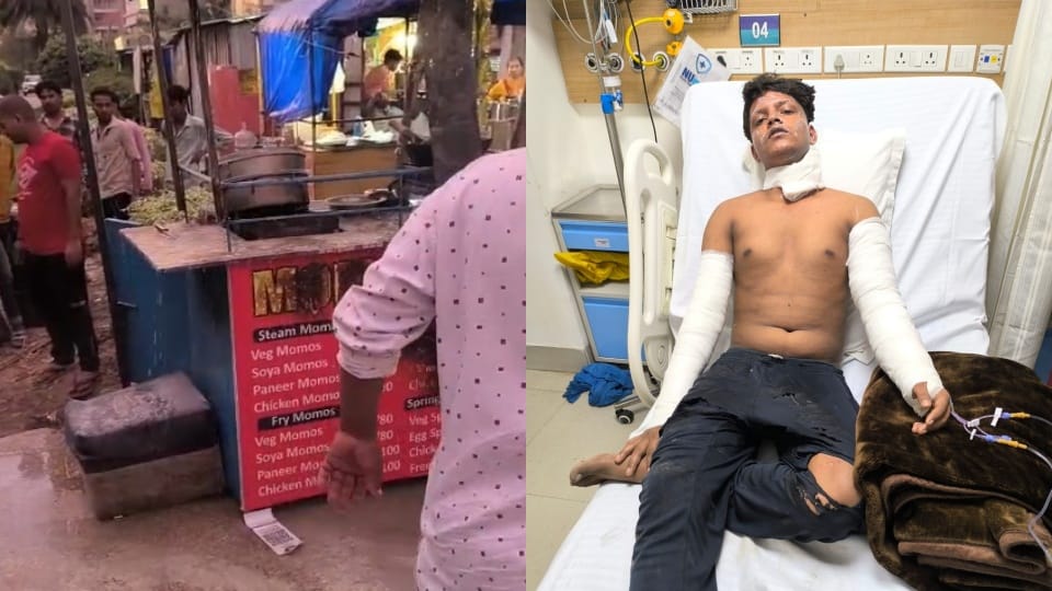 Momos seller burnt due to leakage in cylinder in Greater Noida