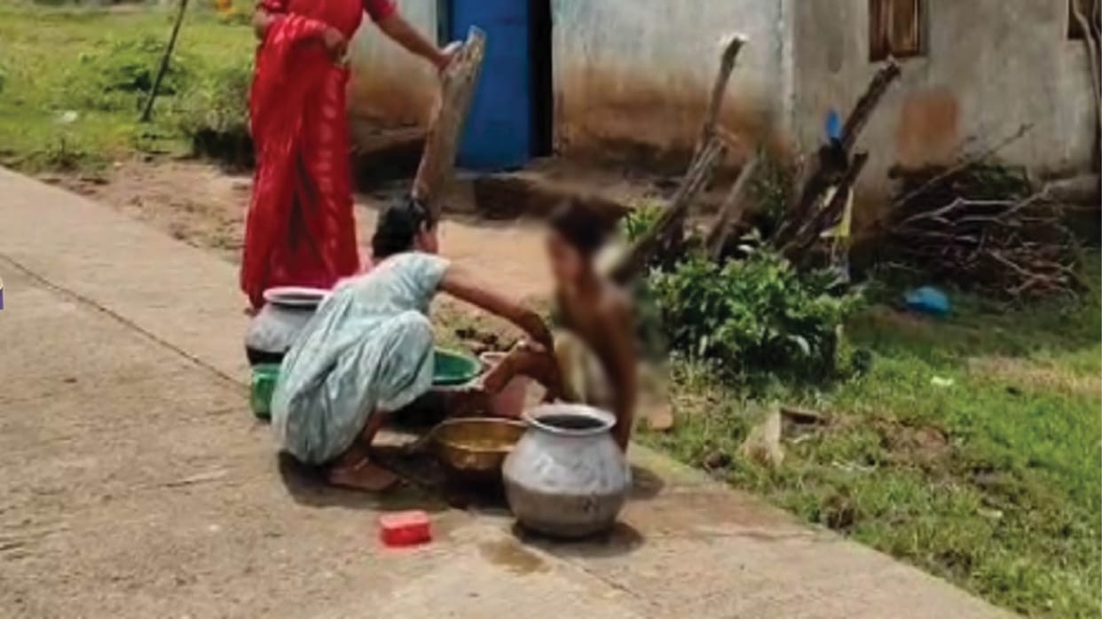 A woman is treating a child suffering from jaundice