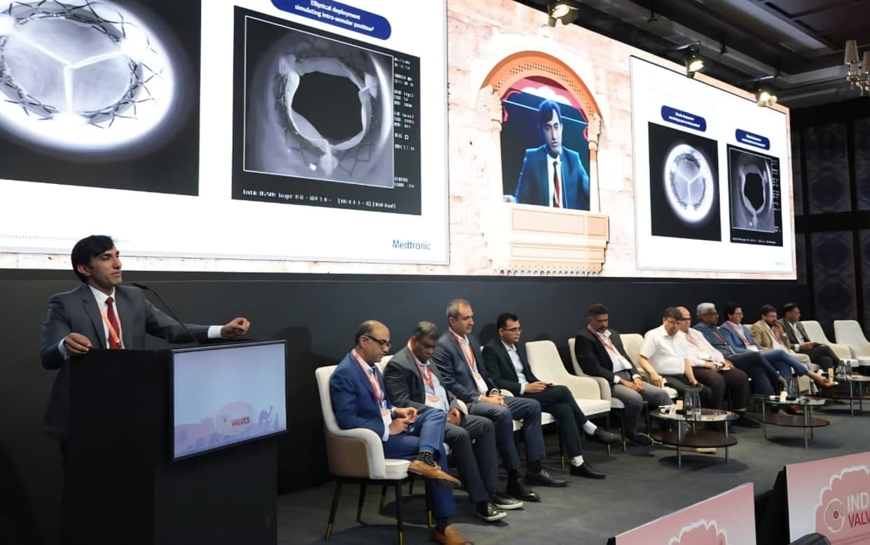 India Valve 2025 Jaipur: Non-Surgical Heart Valve Replacement Now Possible, Say Experts at India Valve 2025