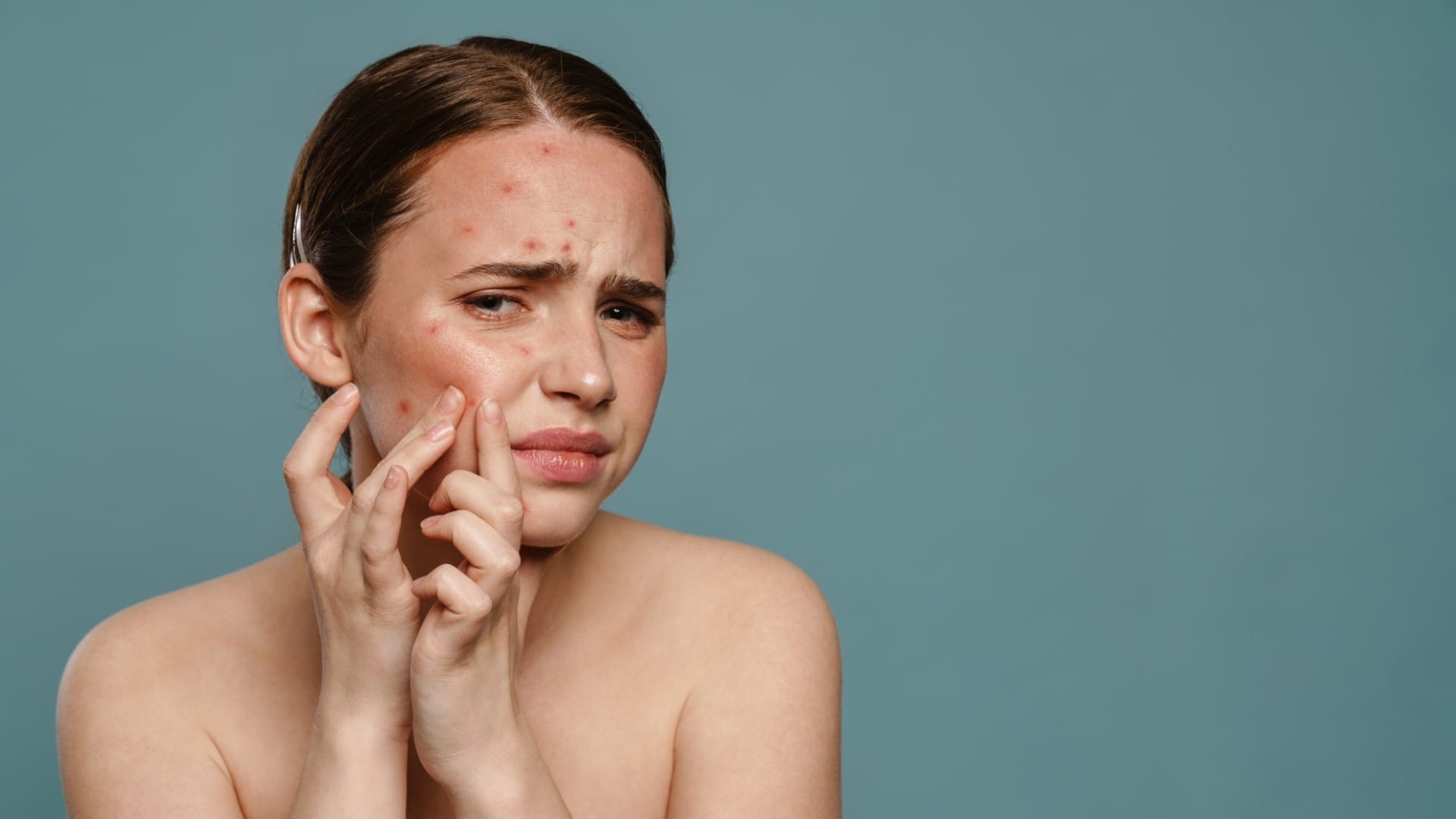 skin care tips muhase ko kam kaise kare gharelu upay batao