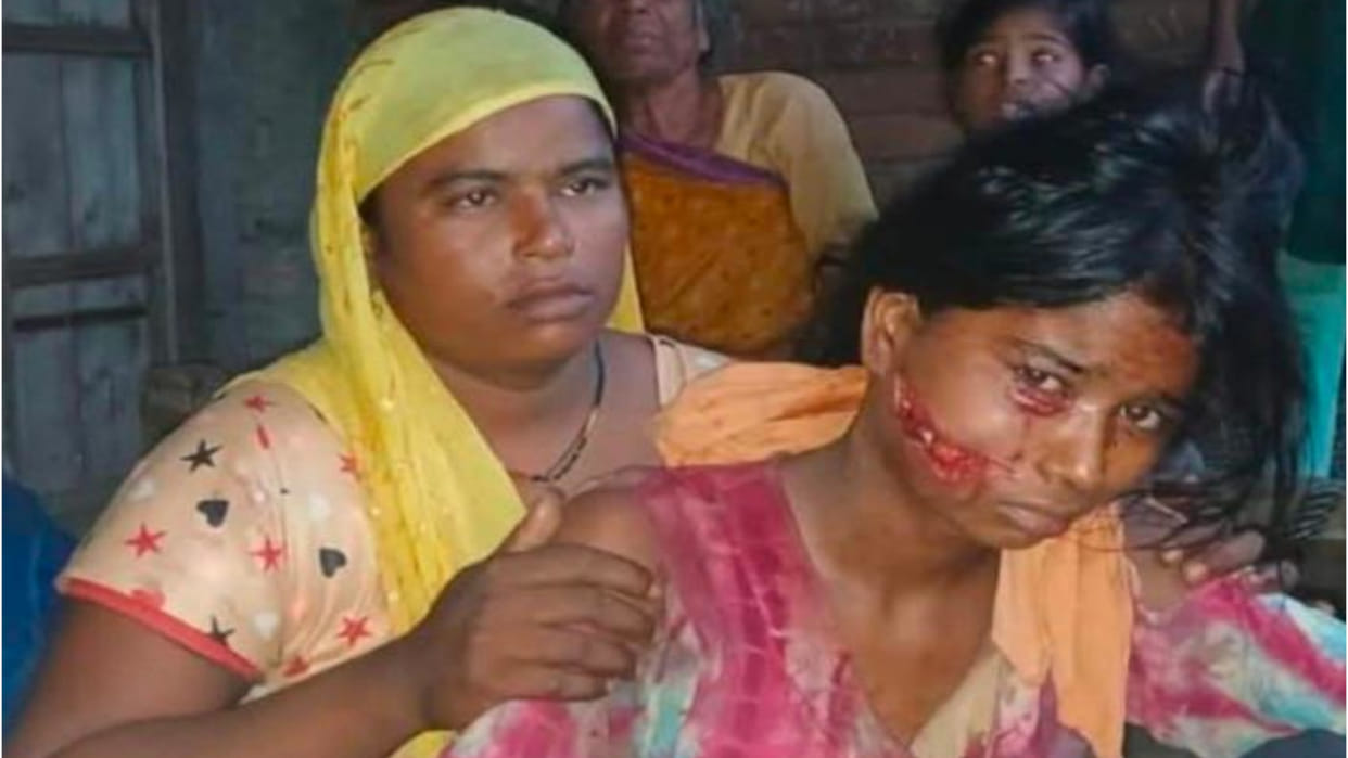 A teenage girl was injured in a leopard attack in Maharajganj, villagers were terrified.