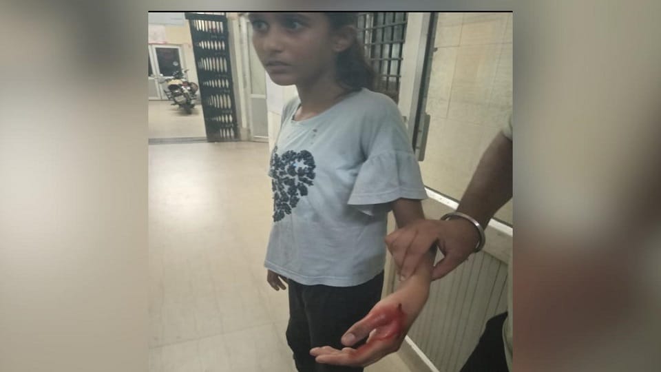 Meerut: BJP leader's ten year old daughter attacked by a pack of dogs, this is the condition of the girl