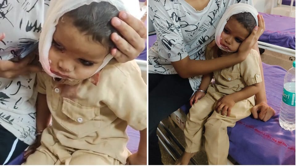 Two and a half year old child attacked by dogs in Ambala