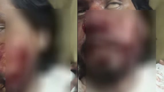 Kanpur Friend beats young man to death seriously injured passersby save his life hospitalized