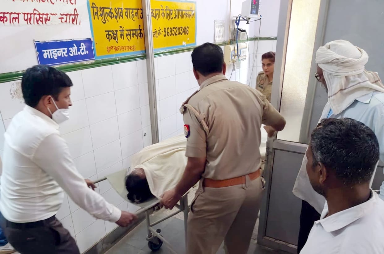 Acid thrown on school teacher in Sambhal face and stomach burnt