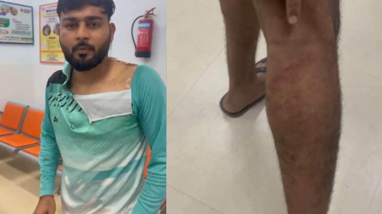 Bihar News: Police beat up PACS president, his wife, and son! A complaint was filed with the SP