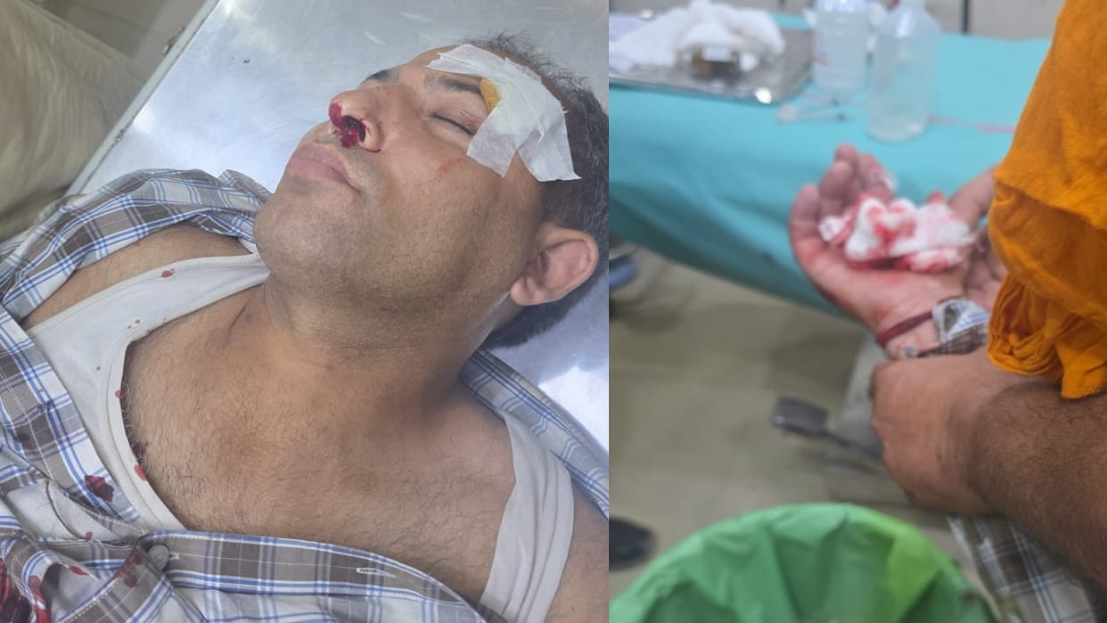 Rampage by goons in Ambala: dispute over parking a scooter led to an attack by men