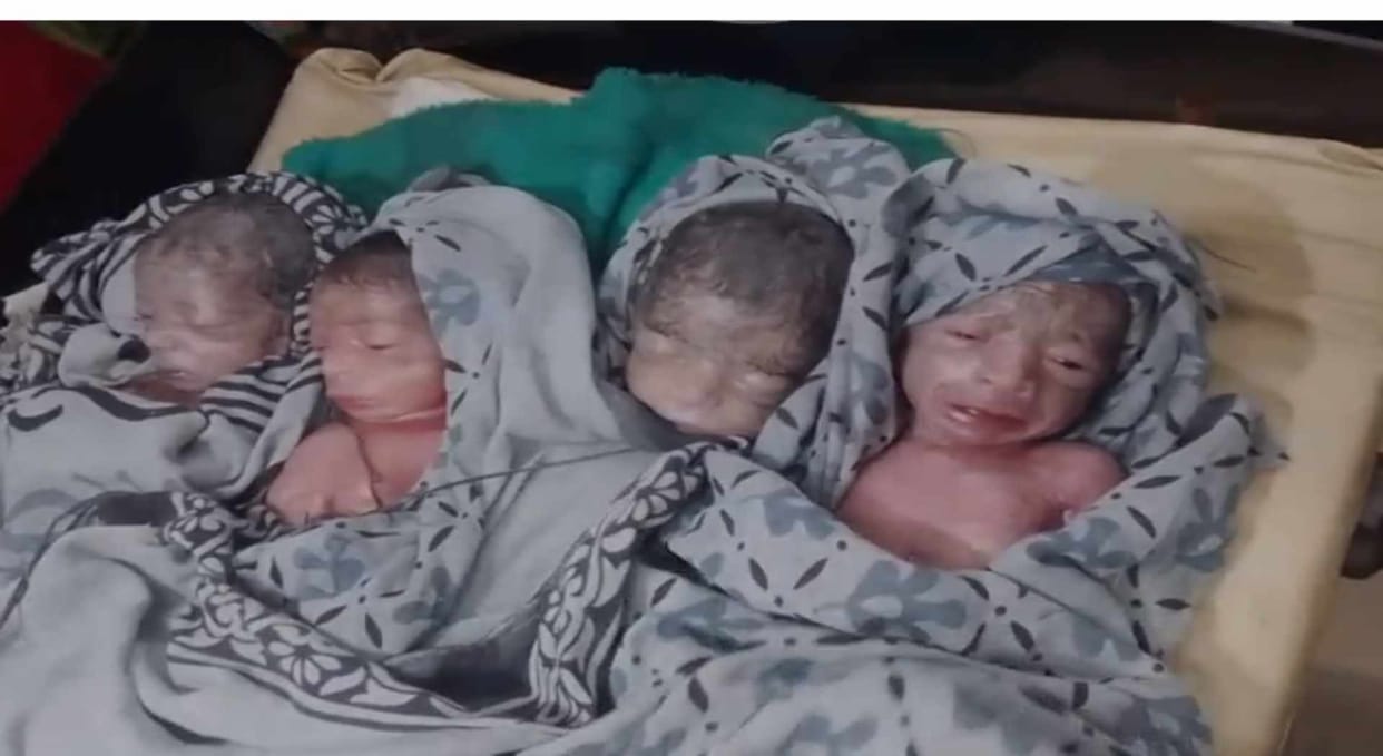 purnia medical miracle sonography showed 3 delivery 4 daughters born