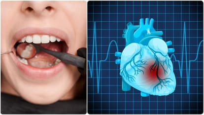 oral hygiene problems could increase your risk of developing heart disease and pancreatic cancer