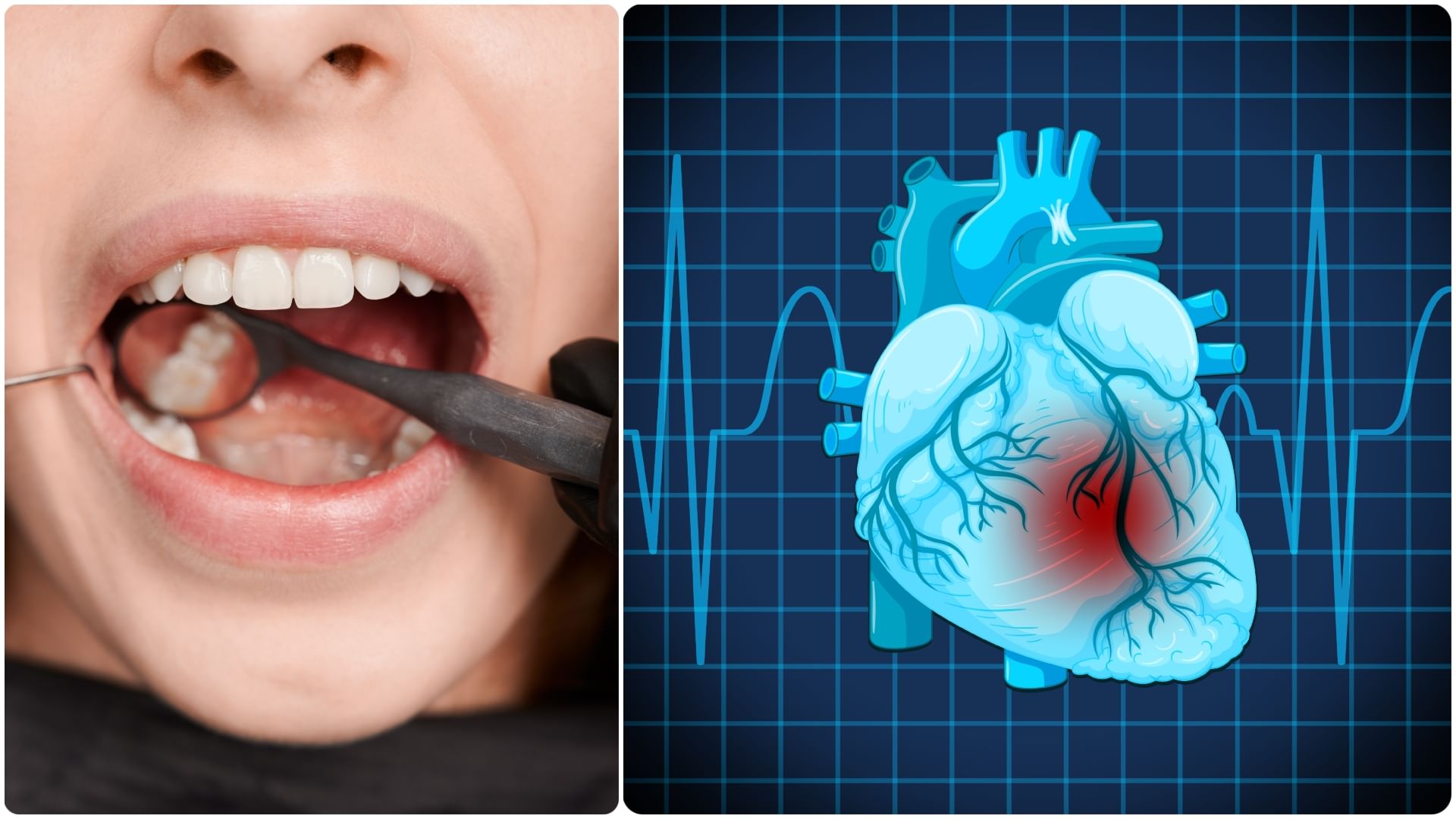 world heart day 2025 poor oral health may cause cardiovascular disease and heart attack