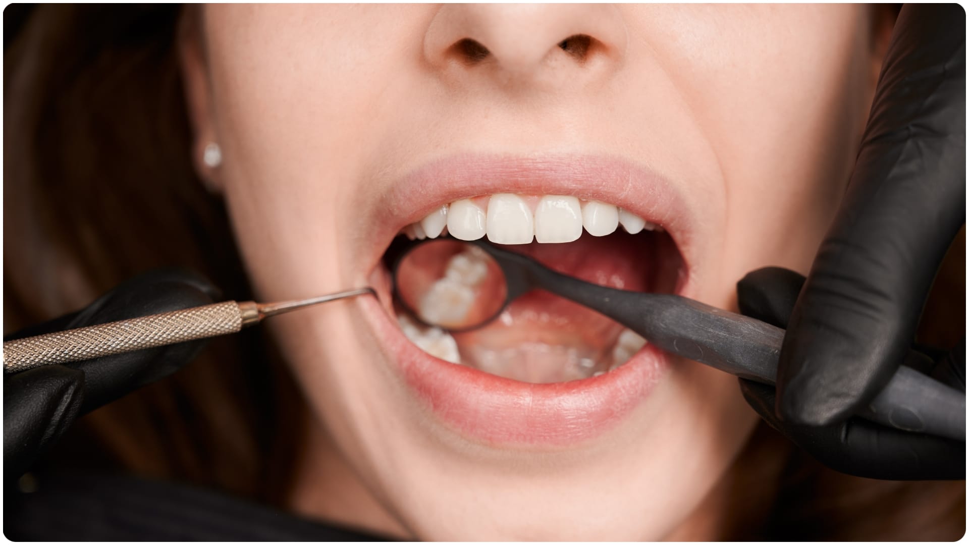 acidic food items that damages your teeth what not to eat to keep teeth healthy