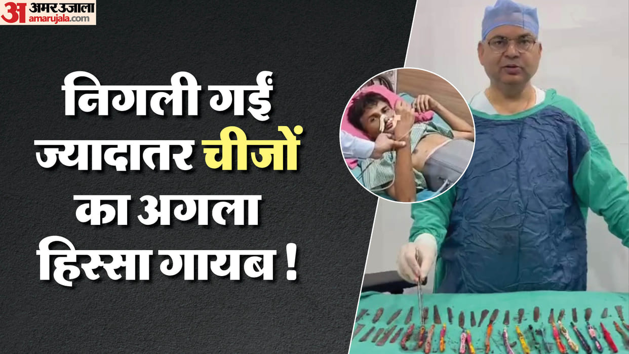 29 spoons 19 toothbrushes and two pens were found in stomach of a patient in Hapur