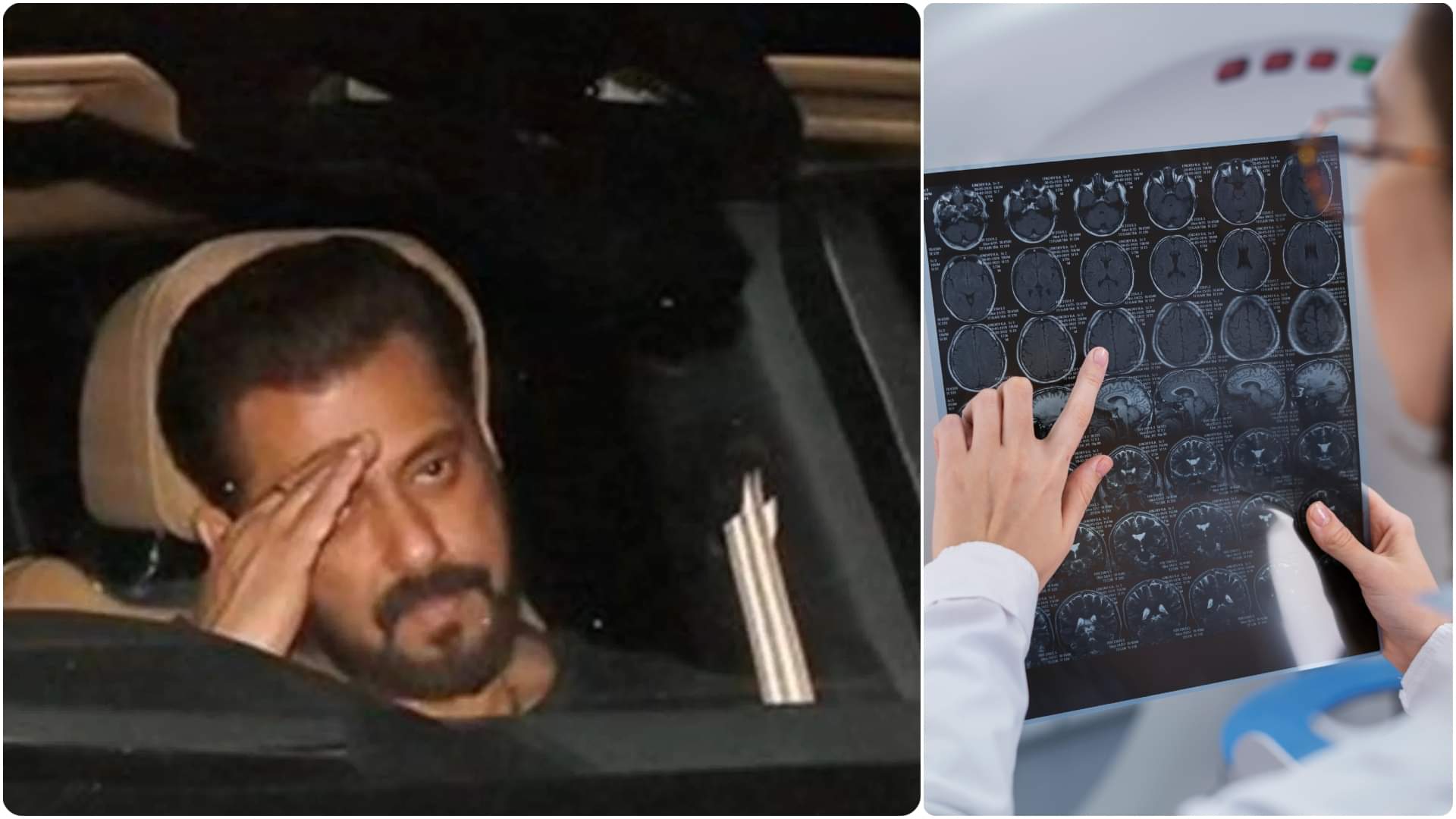 Salman Khan revealed his battle with multiple neurological diseases brain emunirsm trigeminal neuralgia