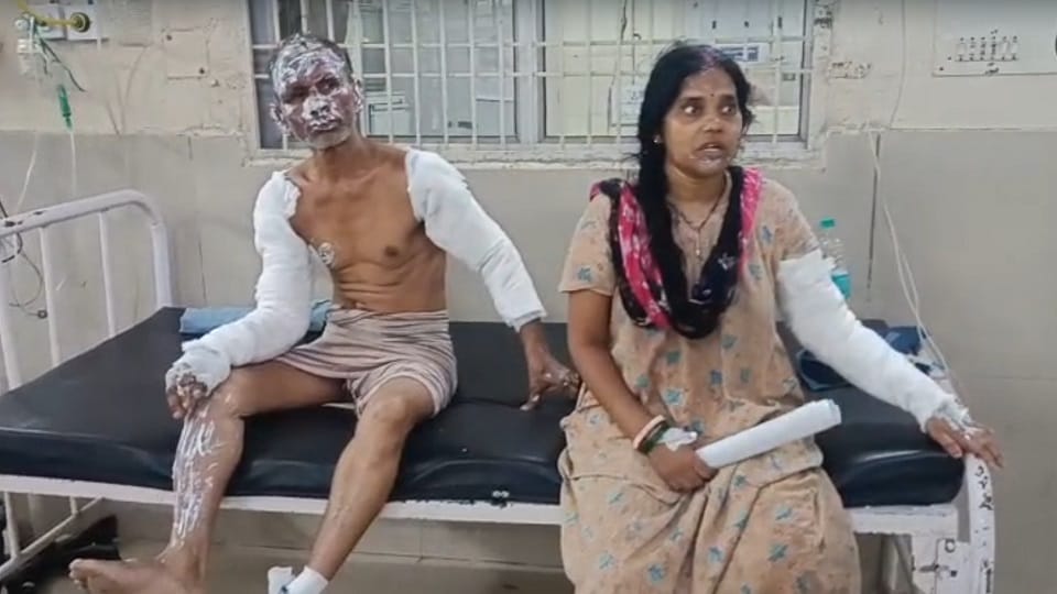 Husband and wife injured due to gas cylinder leak in Sonipat