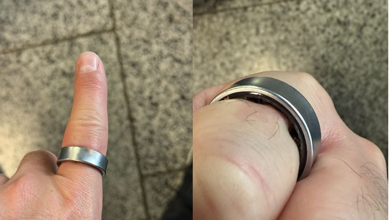 samsung galaxy smart ring battery swelling user hospital incident