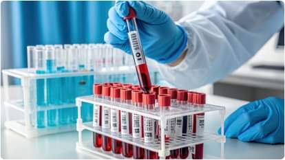 250 units of blood are needed daily in Jammu