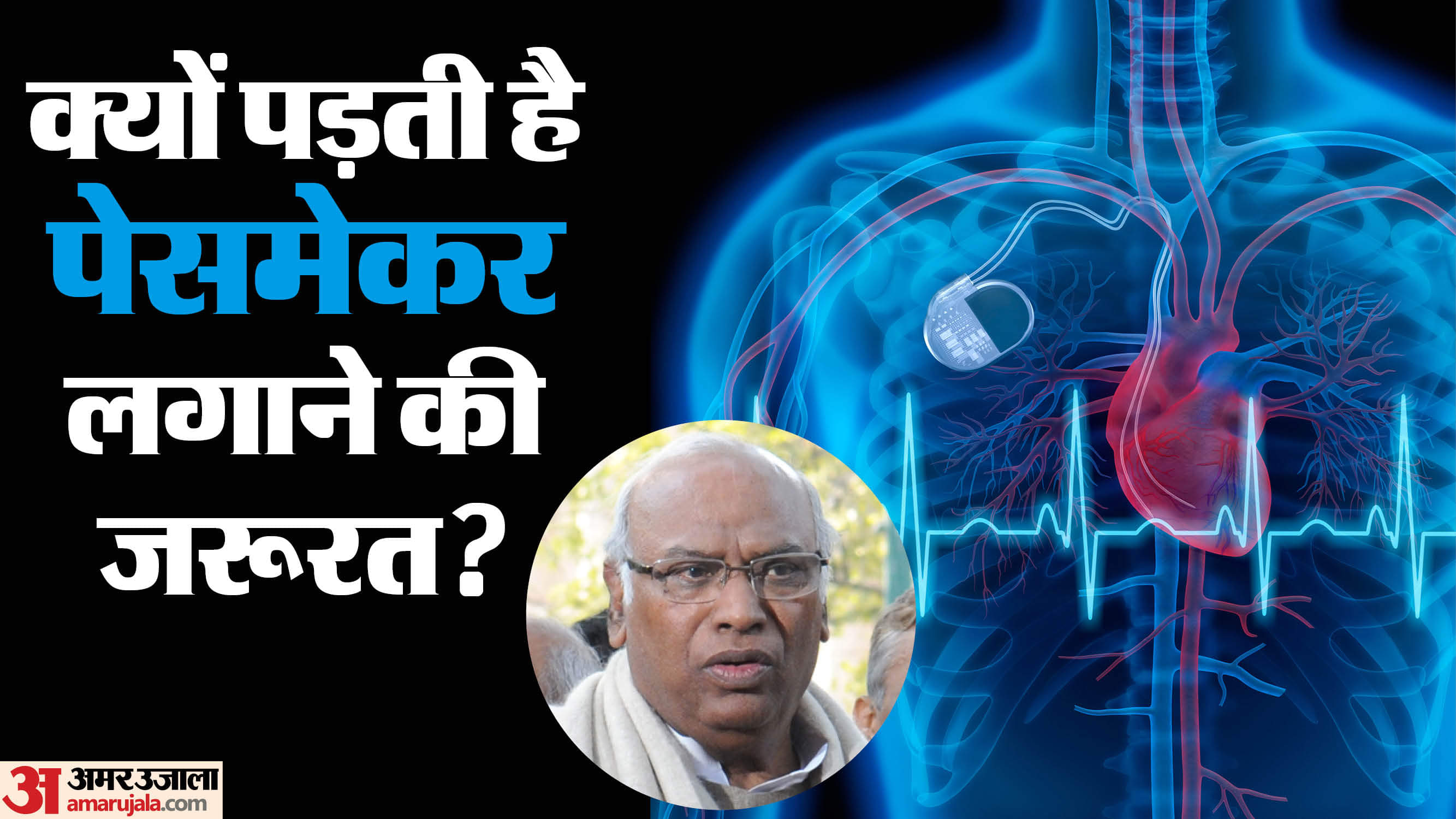 pacemaker implantation procedure of mallikarjun kharge what is pacemaker and how it works