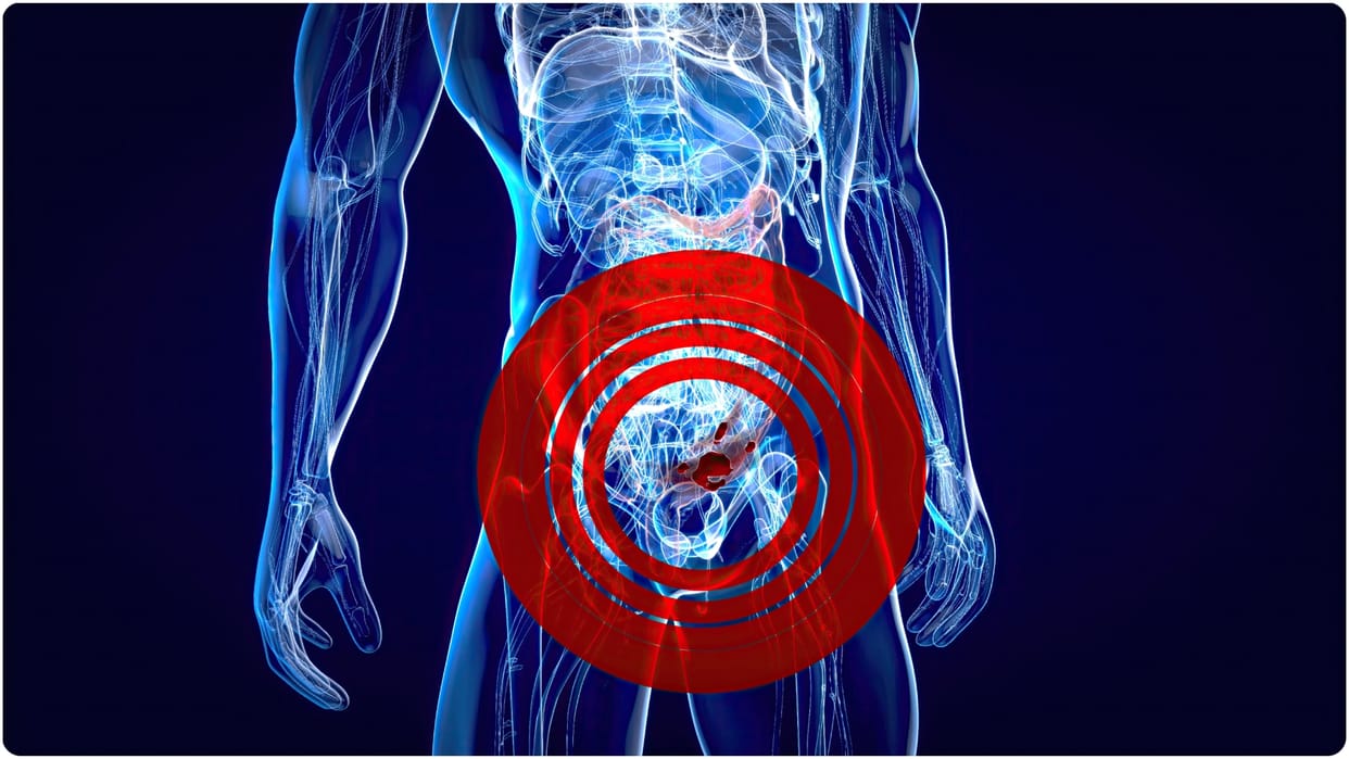 Gastrointestinal Stromal Tumor GIST cancer risk factors and details know its causes in hindi