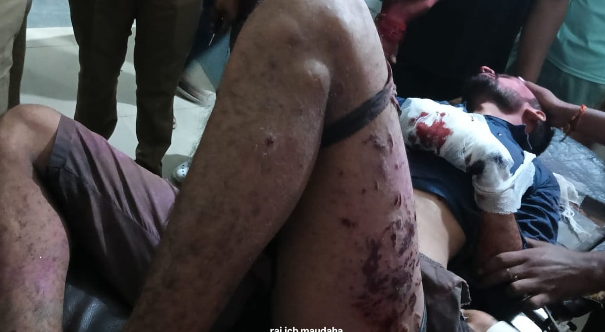 Hamirpur Accident on way to idol immersion youth injured after firecrackers kept in his pocket exploded