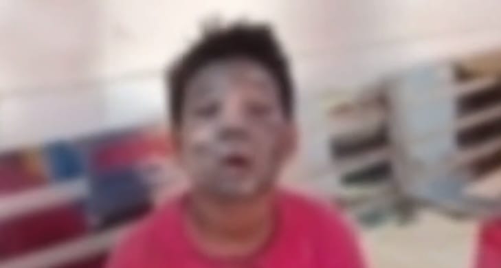 Kanpur Teenager was collecting leftover gunpowder from firecrackers got scorched when  spark caused explosion