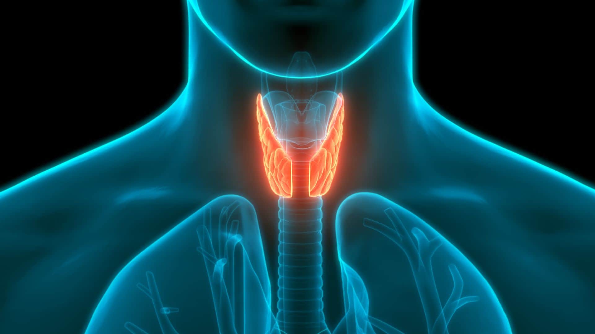 Thyroid Patient Should Avoid These Foods Harmful Foods For Thyroid Patient