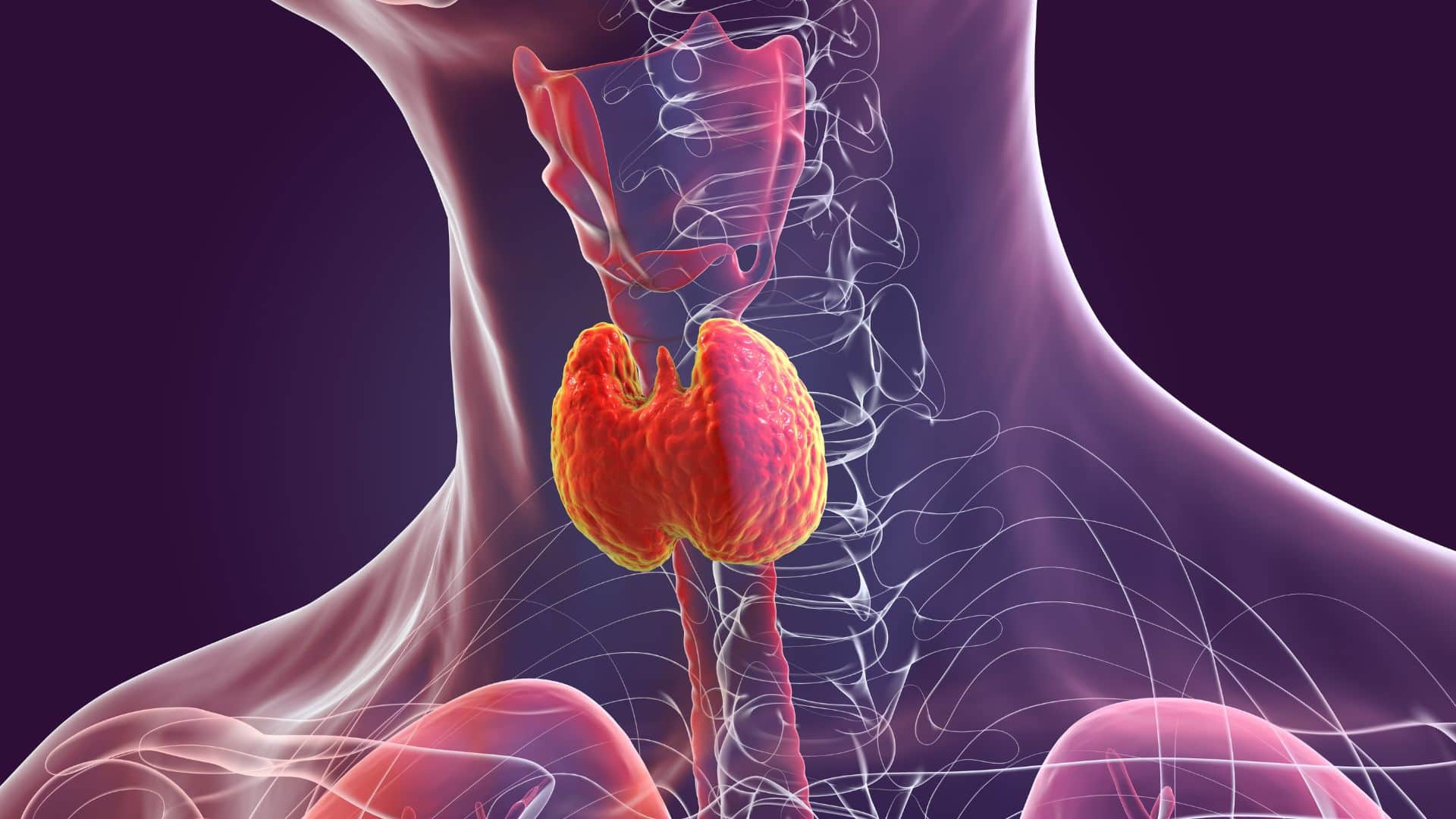 Thyroid Patient Should Avoid These Foods Harmful Foods For Thyroid Patient