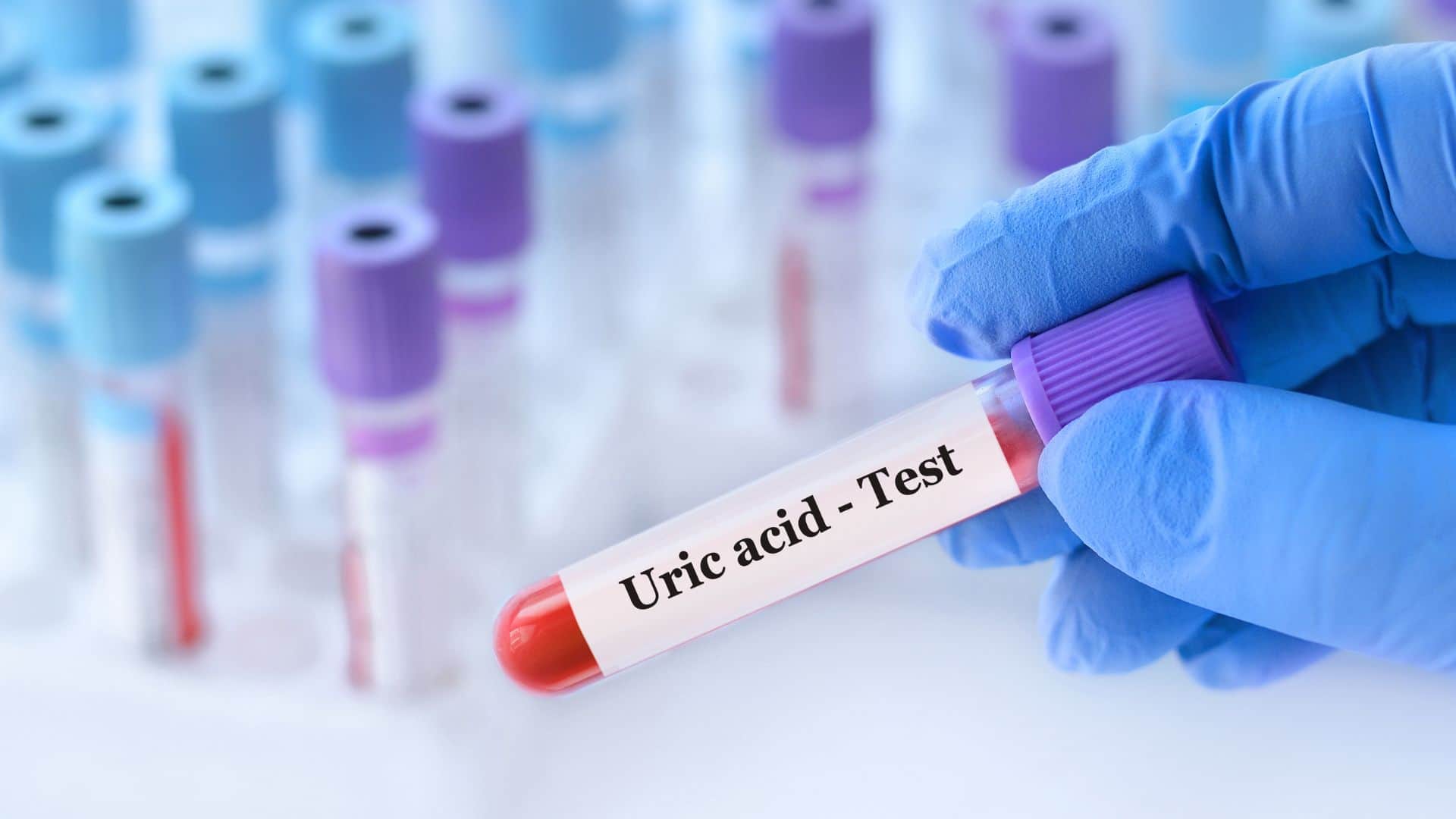 How to Control Uric Acid Levels Naturally to Relieve Joint Pain and Gout Symptoms