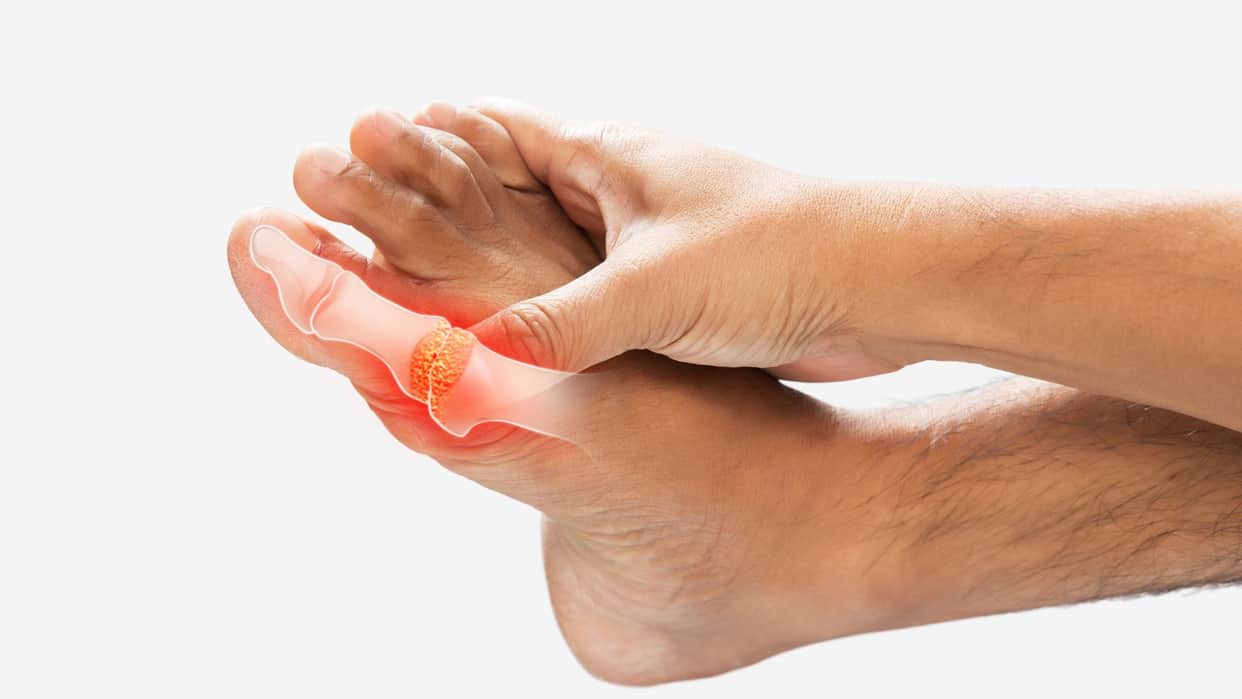 Health Tips: Sudden Pain Due To High Uric Acid Know Three Simple Ways To Control