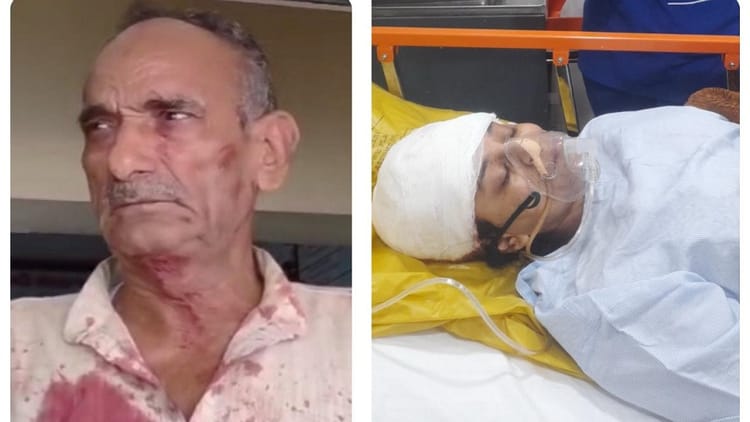 पुत्रवधू पर हमला: सिर और गर्दन पर मारा फरसा, हाथ आगे किया तो उसे भी काट डाला, खून से लथपथ थाने पहुंचा ससुर