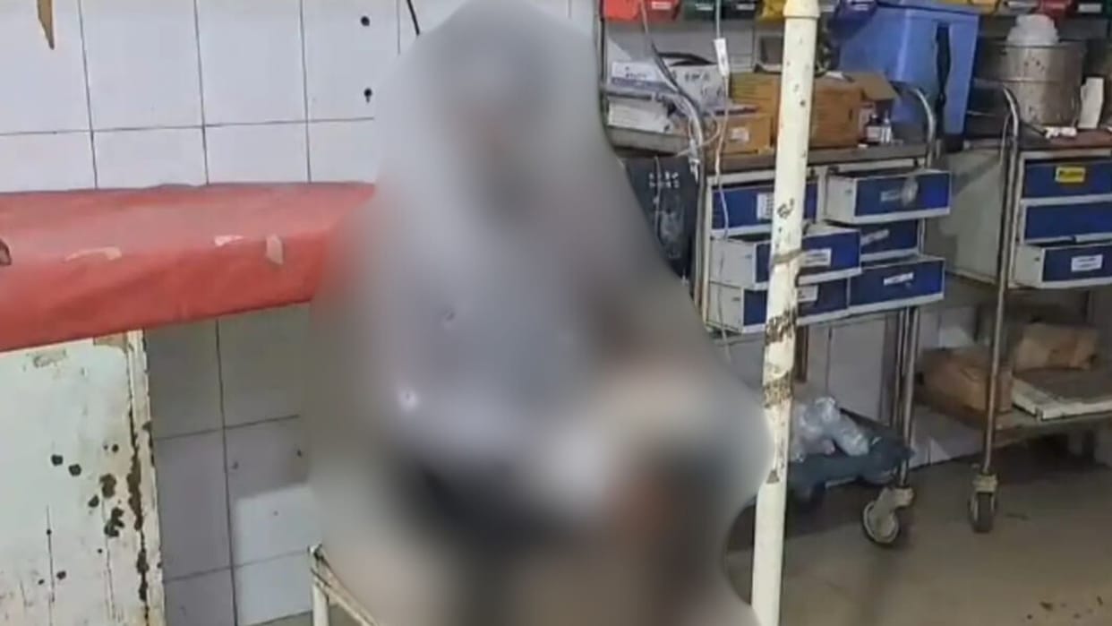 Bihar news: Love affair has turn in tragic when girls has put acid on the boy after asking him