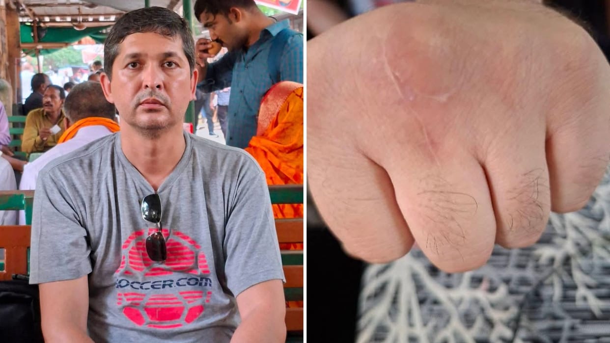 Turkmenistan citizen created ruckus in Varanasi alleging he was extorting money for wrong treatment