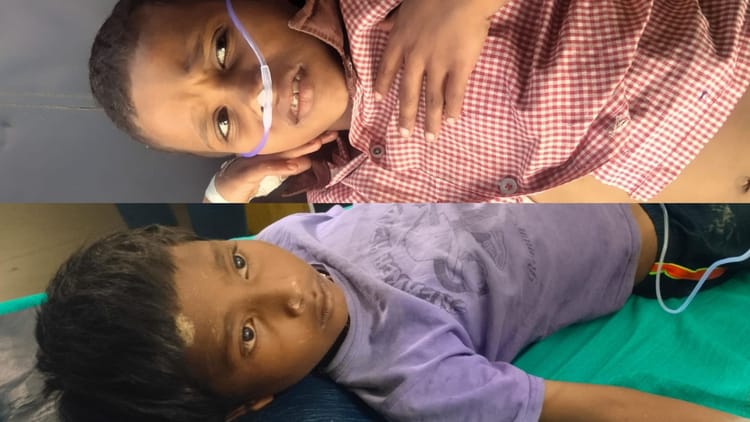 बलिया में दर्दनाक हादसा: स्कूल में बिजली के खंभे पर लटकते तार से चिपके दो चचेरे भाई, हालत गंभीर