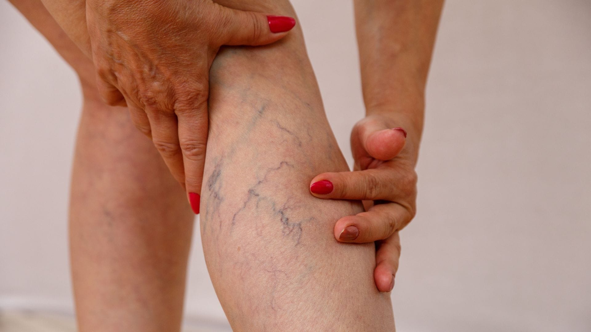 5 Easy Home Remedies for Leg Pain Relief varicose veins Doctor Pairon ke dard ke gharelu upay