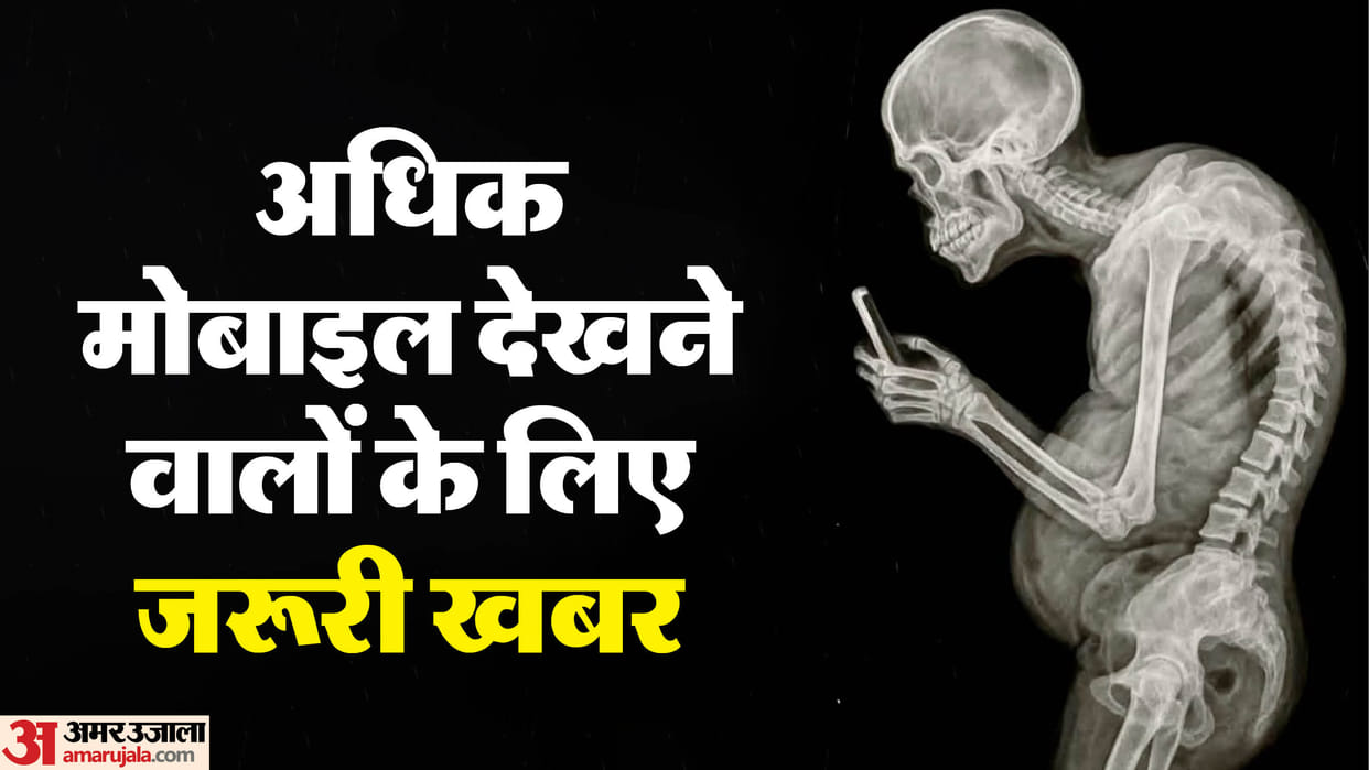 UP News Hunching over while watching mobile phone is causing hump, slouching for hours affects spine
