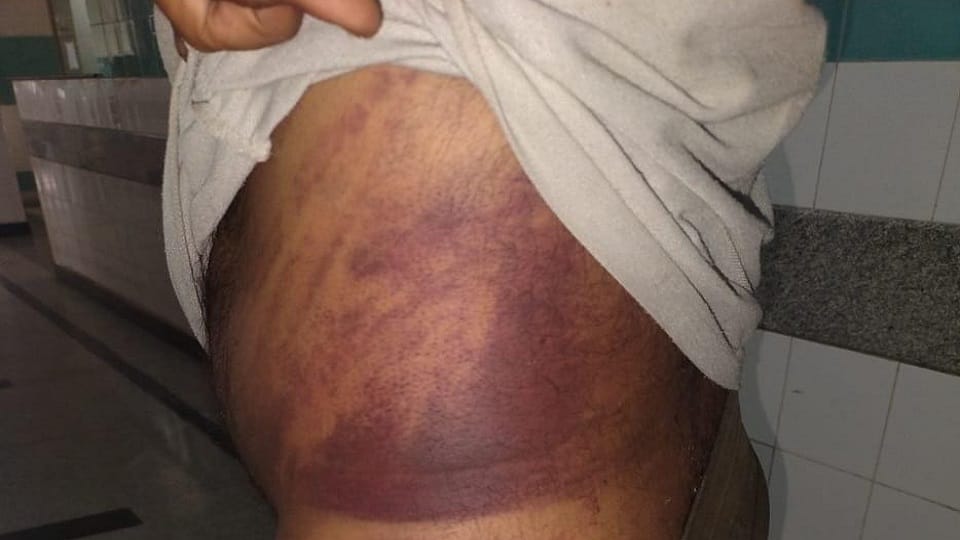 Miscreants beaten a young boy in Sonipat
